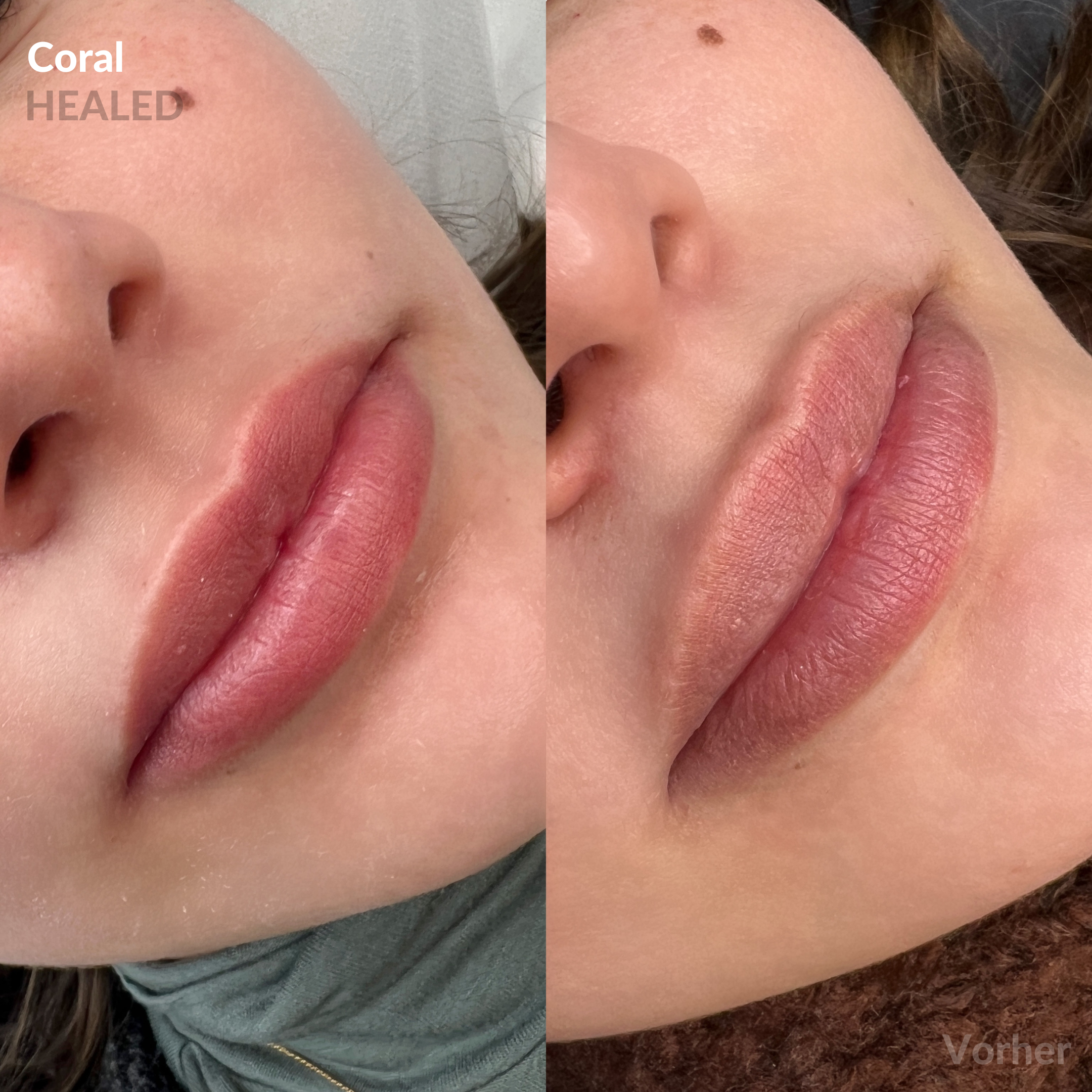 CORAL